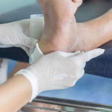 Diabetics Foot Care in the Monmouth County, NJ: Freehold (Manalapan, Carrs Corner, Millstone, Holmeson, Howell, Colts Neck, Marlboro, Spring Valley, Holmdel, Wall) areas