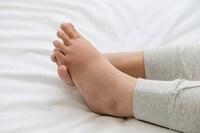 Pregnancy Can Produce Swollen Feet
